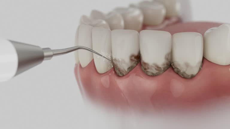 Reliable Dental Implants contractor in Canaan, CT by Smile Center Dentistry
